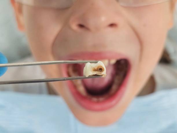 Best Weekend Emergency Dental Services in Ashaway, RI